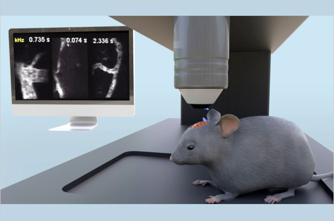 High-speed imaging technology that captures blood flow at the single-cell level in the awake brain