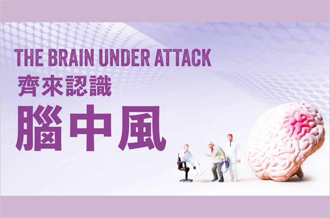 [Apr 2]  The Brain Under Attack