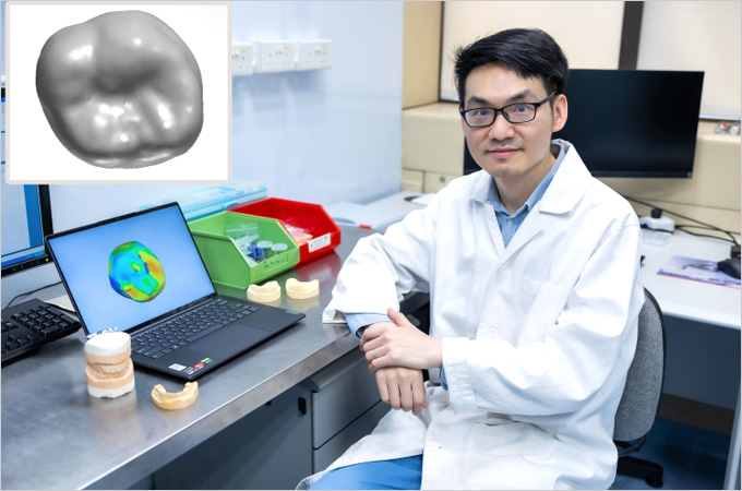 HKU Dentistry develops core technologies using generative AI in smart manufacturing of dental crowns